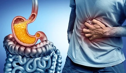 Gastric Disorder